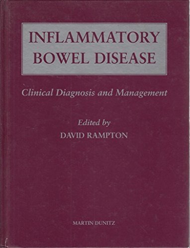 Inflammatory Bowel Disease: Clinical diagnosis and management