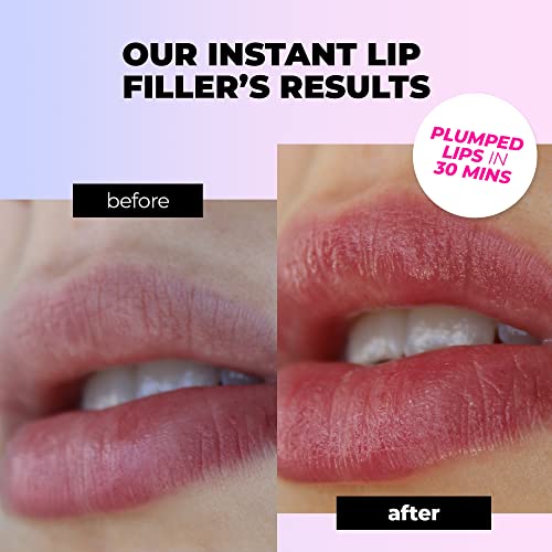 Instant Lip Filler For Plumped Lips In 30 Mins By Vitamasques - Vegan Collagen, Multi-Molecular Hyaluronic Acid & 400 Dissolving Micro-Dart Technology For Instant & Long-Lasting Results #TOP2