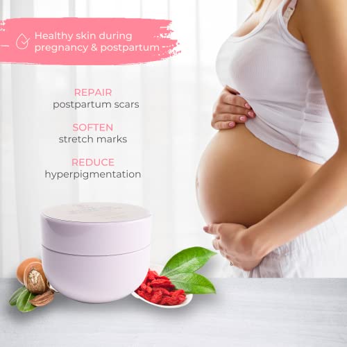 Levitural Stretch Mark & Scar Removal Cream For Pregnancy, Postpartum (2-In-1) - Maternity Skin Care Moisturizer Stretch Mark Prevention With Antioxidant Goji Extract - Extra Large Volume (8.8 Oz) #TOP5