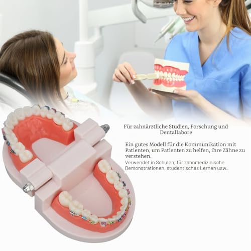 Kieferorthopädisches Zahnmodell, Typodonten Kieferorthopädisches Demonstrationsmodell mit Metalldrähten und Bracket Lehr-, Lern-, Interpretationsmodell für Erwachsene und Kinder