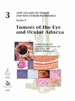 Nonmelanocytic Tumors of the Skin (Atlas of Tumor Pathology Series IV) [ハードカバー] Patterson，James W. Amazon | Nonmelanocytic Tumors of the Skin (Atlas of Tumor