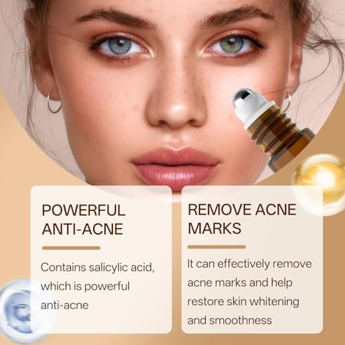 Anti Pigmentflecken & Pickelmale Roll-On, Spot Treatment zur Reduzierung von Pigmentflecken, Altersflecken und Pickelmalen, pigmentflecken Entferner Gesicht