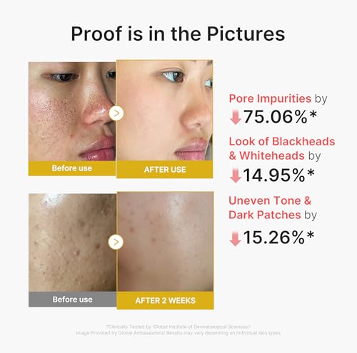 Image of medicube Peel Shot with Kojic Acid Turmeric | Reset in One Step | Gentle Exfoliating Serum with BHA, LHA, PHA for Dead Skin Cells, Blackheads, Excess Sebum | For Dull, Rough, Troubled Skin | 2.7 fl.oz