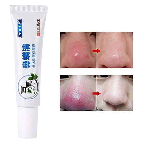 Rosacea Skin Care Products Rosacea Treatment for Face Redness Relief, Inflammation & Anti Acne, Moisturizing, Suppress Bacteria and Itching Cream Cover