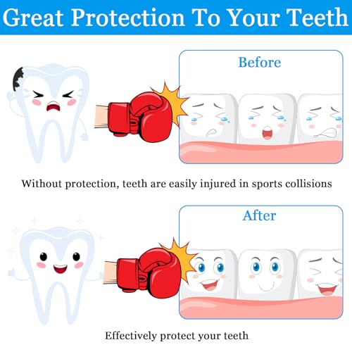 6 Pack Mouth Guard for Sports with Storage Box,Youth Mouth Guard Football Silicone Mouthguard Boxing,Unformable for Teeth - Thumbnail 4
