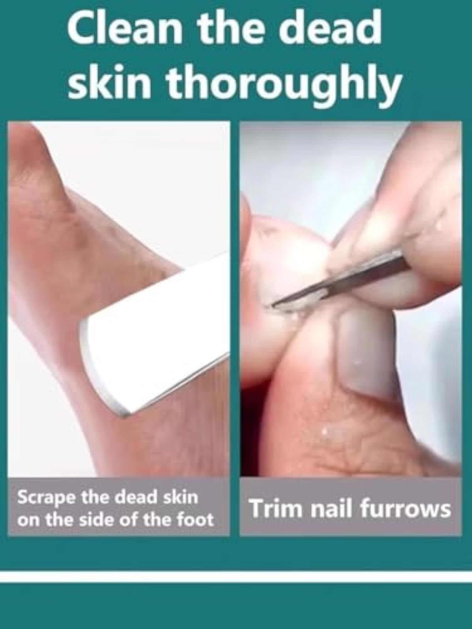 Pedicure Knife Set for Dead Skin and Callus Removal