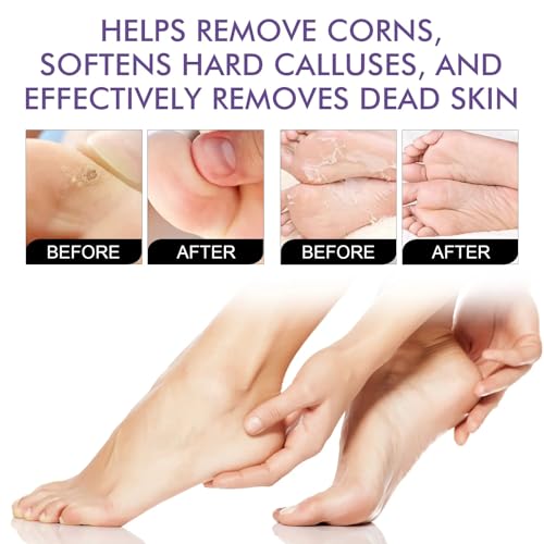 5 Pares de Máscaras Hidratantes de Pies, Máscara para Pelar Los Pies, Calcetines Exfoliantes para Los Pies, Mascarilla Exfoliante de Pies, Restaurar los Pies Suaves Del Bebé, para Hombres y Mujeres - imagen 4