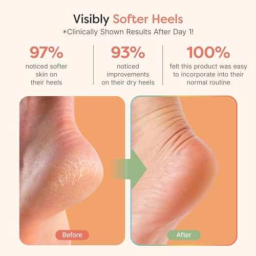 ZenToes Moisturizing Socks for Cracked Heel Treatment, Vitamin E, Olive Oil and Jojoba Oil Infused Heel Socks, Spa , (Fuzzy Pink, Regular)