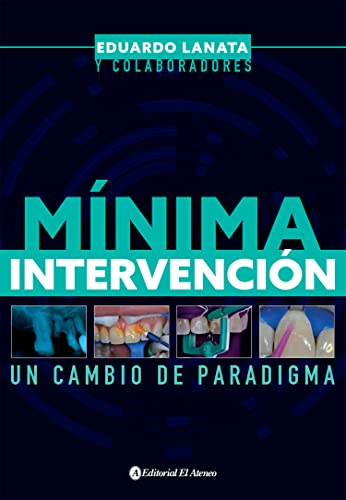 Mínima intervención: Un cambio de paradigma (Spanish Edition)