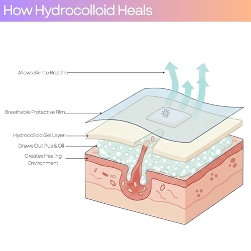 Image of Medical Grade Hydrocolloid Dressing Roll, For Wound And Acne Care, Waterproof Wound Care Tape, Cut-to-Fit for Blisters, Burns, Acne & Skin Protection (5 Cm x 500 Cm)