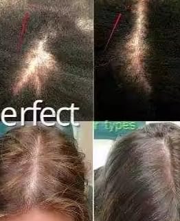 Miniatura 9 de Aceite para el cabello Batana 100% orgánico Nutre el cuero cabelludo acondicionador profundo prensado en frío y orgánico cultivado en Honduras