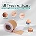 Silicone Scar Tape, Silicone Scar Sheets, Scar Tape for Surgical Scars, Silicone Tape for Scars, Scar Sheets for Surgical Scars, C-Section, Tummy Tuck and Keloid (1.6