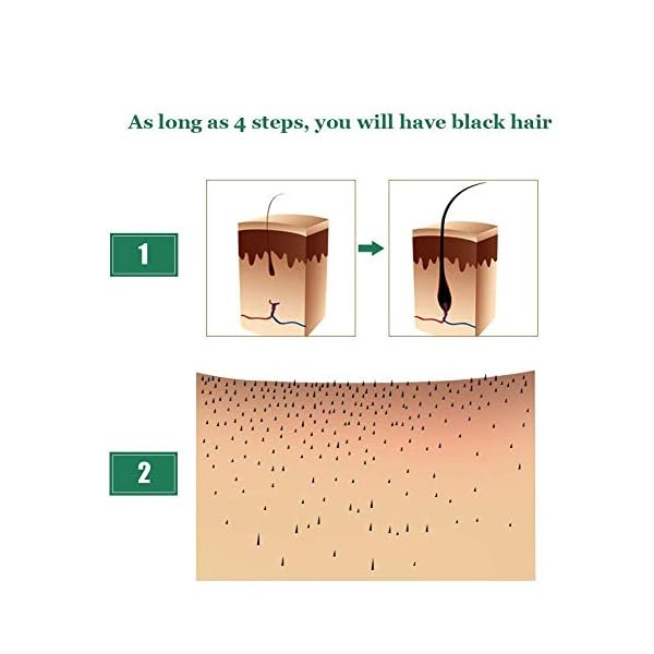 Hair-Growth-Oil2021-Hair-Growth-SerumHair-GrowthStops-Hair-Loss-Hair-Thinning-Treatment-Hair-Growth-TreatmentEssential-Oil-for-Women-Men-50ml Hair Growth Oil,2021 Hair Growth Serum,Hair Growth,Stops Hair Loss, Hair Thinning Treatment, Hair Growth Treatment,Essential Oil for Women Men-50ml…