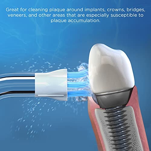 Replacement Tips for Waterpik Water Flosser (2 Classic Jet Tips + 2 Orthodontic Tips + 2 Plaque Chaser Tips+ Storage Case Combo) - Thumbnail 3