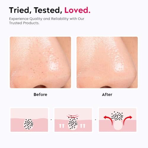 Image of Gleva Double-Headed Facial Massage Brush, Deep Pore Cleansing, Skin Exfoliator Brush, Face Mask Mud & Clay Applicator, Lips Face Cleansing, Cosmetic Tools (Rose),Silicone Facial Brush