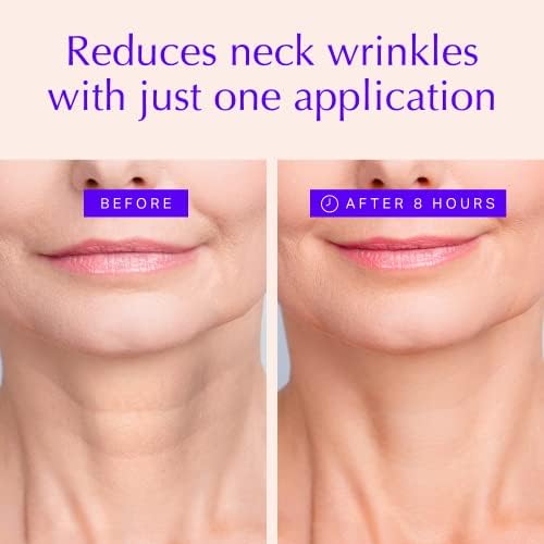 Neck Wrinkle Pads - Anti-Aging Advanced Skin Firming & Neck Tightening  Treatment - Skin-Safe Silicone Skincare Patches - Overnight Reusable Crepe  ...