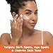 Palmer's Cocoa Butter Formula Eventone Fade Cream, Anti-Dark Spot Fade Cream with Vitamin E and Niacinamide, Helps Reduce Dark Spots & Age Spots, 2.7 Ounce