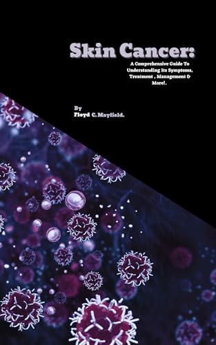 Skin Cancer: A Comprehensive Guide To Understanding Its Symptoms, Treatment , Management & More!