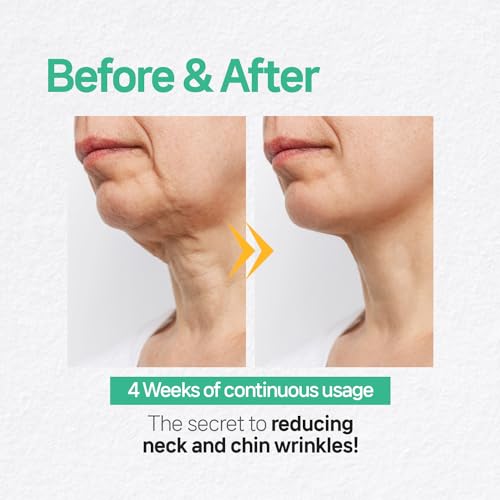 Wooshin Labottach Chin Lifting Mask 4ct – Korean Hydrogel Neck & Chin Patch for Sagging Skin, Neck Wrinkle Patches & V-Line Lifting, Firming Overnight with Hyaluronic Acid & Vitamin E — view 6