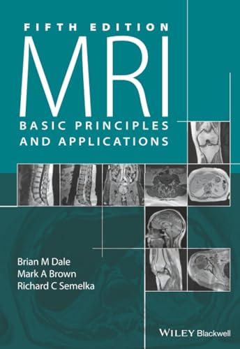 MRI: Basic Principles and Applications