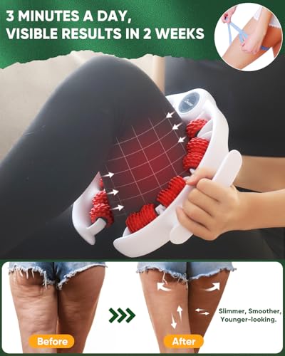 ONUEMP Cellulite Massager Roller - Save 30% Off - Image 3