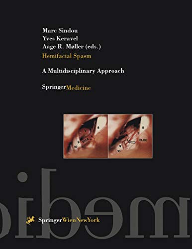 Hemifacial Spasm: A Multidisciplinary Approach (English Edition)