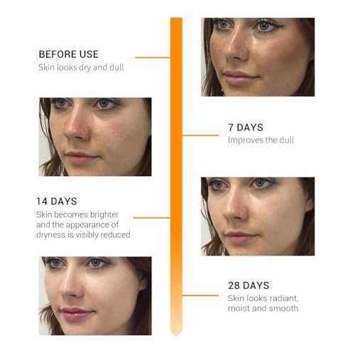 Generic F.o.r.e.c.a.s.t Skin Naturals, Face Serum, Increases Skin's Glow Instantly and Reduces Spots Overtime, Vitamin C Booster, 30 ml