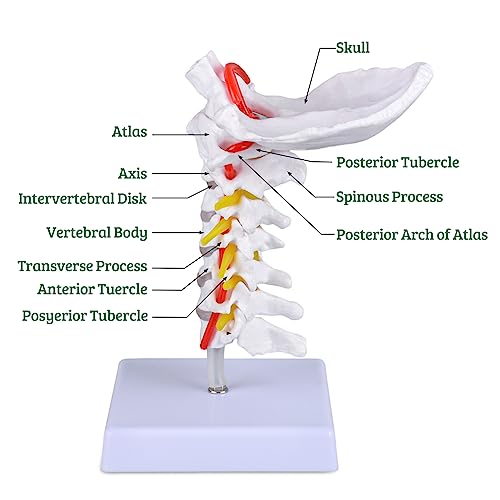 Image of Ultrassist Cervical Spine Model, Vertebrae and Arteries for Medical Tool | Life-size PVC design, cervical nerves, discs and occipital plate for teaching display