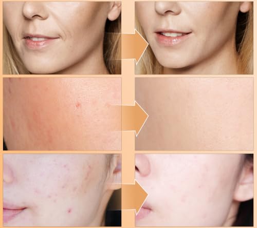 ABOTE Snail Mucin Face Serum 120ml with 96% Snail Secretion Filtrate — view 4