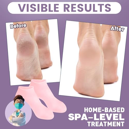 5-Pairs-Silicone-Socks-for-Dry-Cracked-Feet-Silicone-Moisturizing-Socks-for-Women-Foot-Care-Silicone-Socks-Spa-Gel-Socks-Foot-Care-After-Pedicure-5-Colors-Assorted