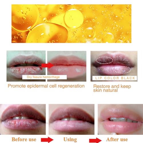 Ginger Lip Lightening for Dark Lips,Lips Pink Bleaching Cream Balm,Lip Balm,Fast Moisturizing Lightening Lip Balm,Brightening Cream Blam,Lip Care Lightens Remove Dark Lips,Lip Pigmentation Treatment - Image 7