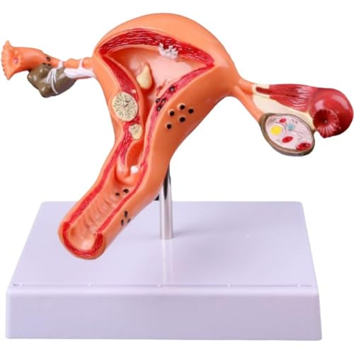 Modèle anatomique d'utérus et ovaire outil d'étude de section médicale