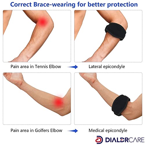 Image of DIALDRCARE Neoprene Elbow Brace For Tendonitis Pain Relief, Forearm Pain, Physical Therapy-Adjustable Elbow Strap Support With Compression Pad (Black) (2)