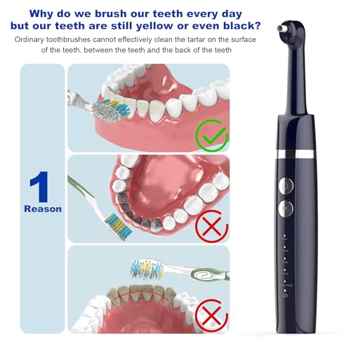 Image of Tooth Polisher,Teeth Polishing Kit for Daily Cleaning,Polishing Then Whitening of Tooth (Professional Toothpaste Include),USB Rechargeable Dental Polisher with LED Light,6 Heads,5 Speed Modes
