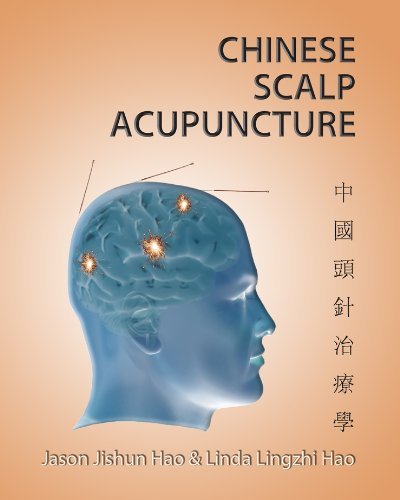 Chinese Scalp Acupuncture: Dr. Jason Ji-shun Hao, Dr. Linda Ling-zhi Hao, Honora Lee Wolfe