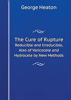 Paperback The Cure of Rupture Reducible and Irreducible, Also of Varicocele and Hydrocele by New Methods Book