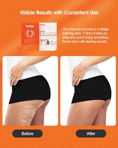 Rovista Anti Cellulite Massage Tool