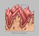 papillae definition in medical term Dimensiones: 60,96 x 45,72 cm The Poster Corp Gwen Shockey/Science Source – Filiform Papillae Illustration Artistica di Stampa (60,96 x 45,72 cm)