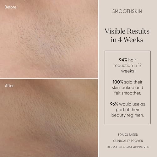 SmoothSkin Pure Mini IPL Laser Hair Removal Device, Long-Lasting, for Body & Facial Hair Removal, Alternative to Laser Hair Removal, Bikini Shaver & Epilator, with Precision Head for Small Areas