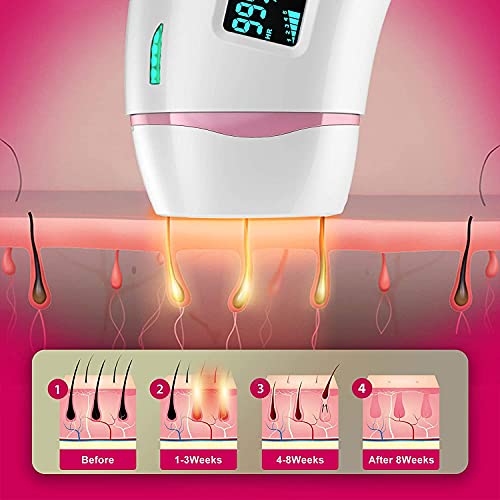 IPL Hair Removal for Women and Men Permanent Painless Laser Hair Removal System 999,900 Flashes at-Home Hair Remover Treatment for Whole Body - Thumbnail 4