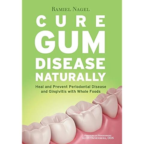 Cure Gum Disease Naturally: Heal and Prevent Periodontal Disease and Gingivitis with Whole Foods Cover