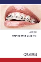 Orthodontic Brackets 3659163759 Book Cover