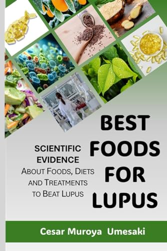Independently Published Muroya Umesaki, César Best Foods For Lupus: What To Eat When You Have Lupus?.... A Compilation Of Scientific Research Explained For Everyone. cover