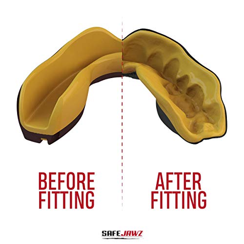 Safejawz Mouthguard Slim Fit, Adults And Junior Mouth Guard With Case For Boxing, Basketball, Lacrosse, Football, Mma, Martial Arts, Hockey And All Contact Sports (Juniors < 11 Years, Gold) #TOP2