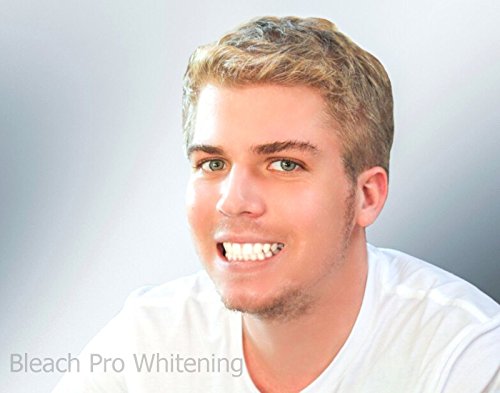 Teeth Whitening Gel 10% Carbamide Peroxide Tooth Bleaching Dispensers 10 pcs - Image 6