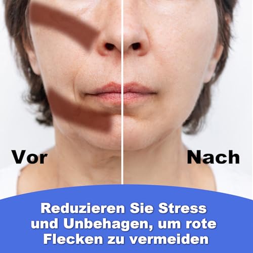 VEGCOO 8-Pack CPAP Gurtbezüge Gesichtspads, Universal CPAP-Gurtpolster, CPAP Maske Kopfband Gurtbezüge, CPAP Komfortpolster für Verringerung von Einbuchtungen und Wange Rote Flecken