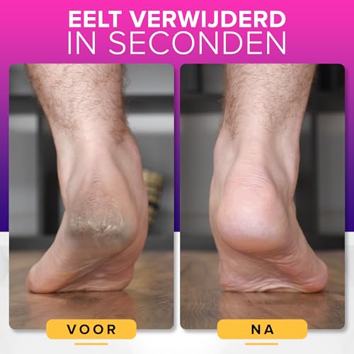 XV-7 Elektrische Eeltverwijderaar – 15-delige Pedicureset - View 1