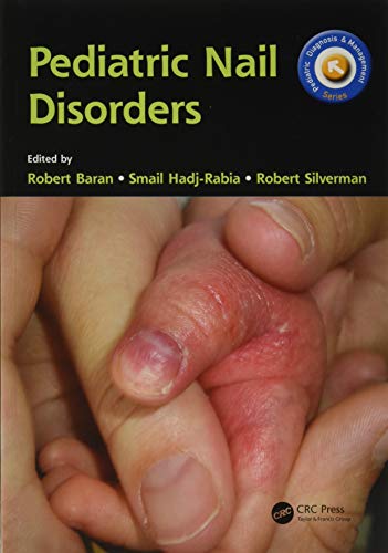 Pediatric Nail Disorders (Pediatric Diagnosis and Management)