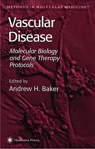 Vascular Disease view 2