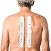 Price comparison product image 2 axion Spinal electrodes Compatible with SANITAS & BEURER Devices - TENS EMS Pads for Back electrostimulation Machines - 3.5mm Button